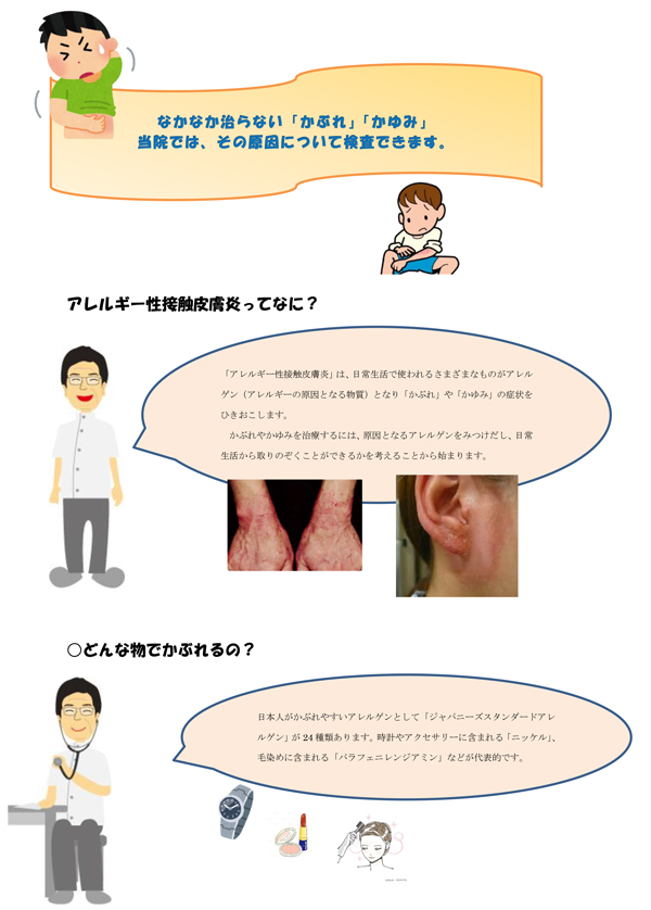 接触性皮膚炎の検査
